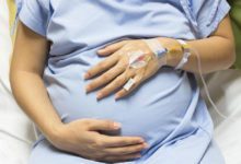 عملية شفط دهون البطن اثناء الولادة القيصرية