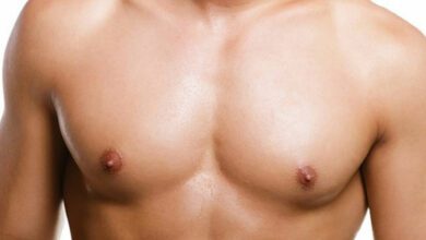 بروز الثدي عند الرجال