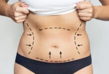 تكلفة عملية نحت البطن