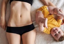 شفط دهون البطن أثناء الولاده القيصرية